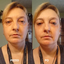 Load image into Gallery viewer, LumiPept™ - Hydrożelowe Płatki Pod Oczy z Peptydami Miedzi | 60 pads