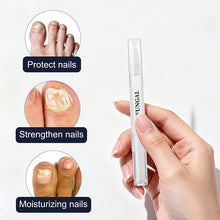 Załaduj obraz do przeglądarki galerii, Nailverra™ - Regenerujące Serum do Paznokci w Pisaku | 1+1 GRATIS