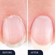 Załaduj obraz do przeglądarki galerii, Nailverra™ - Regenerujące Serum do Paznokci w Pisaku | 1+1 GRATIS