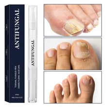 Załaduj obraz do przeglądarki galerii, Nailverra™ - Regenerujące Serum do Paznokci w Pisaku | 1+1 GRATIS