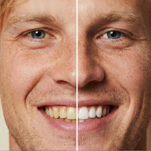 Load image into Gallery viewer, Smilevoria™ Korektor Wybielający do Zębów w Pisaku | 1+1 GRATIS