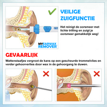 Load image into Gallery viewer, MYEarWaxRemover PRO™ | Met Zuigfunctie